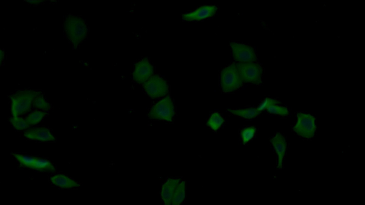 Monoclonal Antibody to Alpha-2-Glycoprotein 1, Zinc Binding (aZGP1)