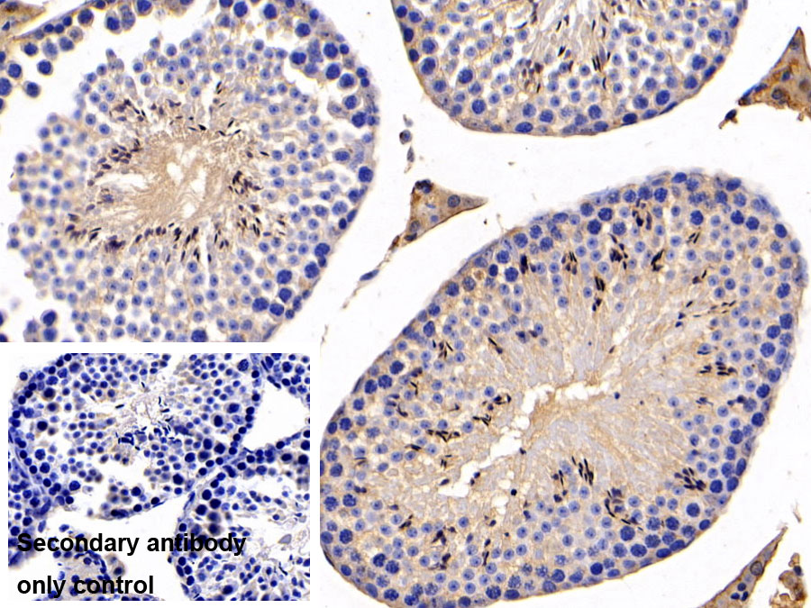 Monoclonal Antibody to C-Type Lectin Domain Family 7, Member A (CLEC7A)