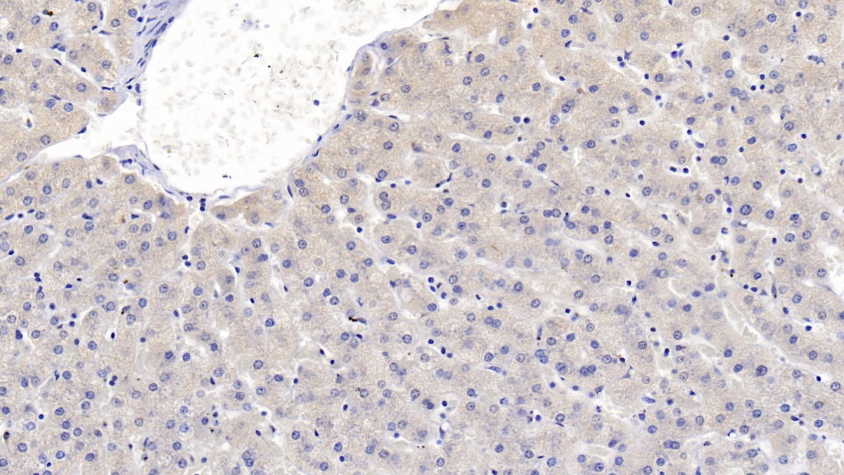 Monoclonal Antibody to Semaphorin 3A (SEMA3A)