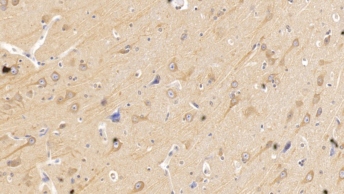 Monoclonal Antibody to Semaphorin 5B (SEMA5B)