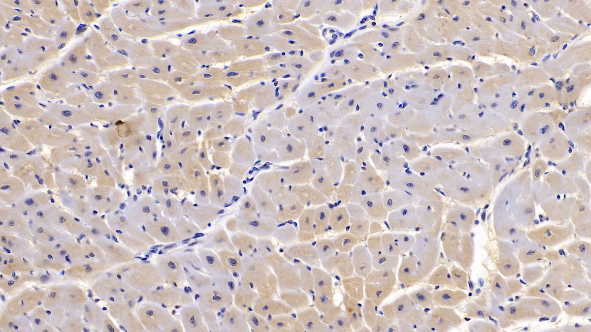 Monoclonal Antibody to Semaphorin 5B (SEMA5B)