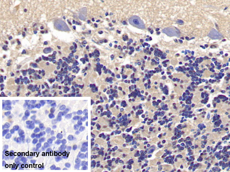 Monoclonal Antibody to Semaphorin 5B (SEMA5B)