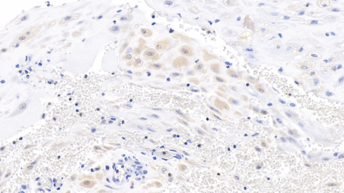 Monoclonal Antibody to Wingless Type MMTV Integration Site Family, Member 3A (WNT3A)