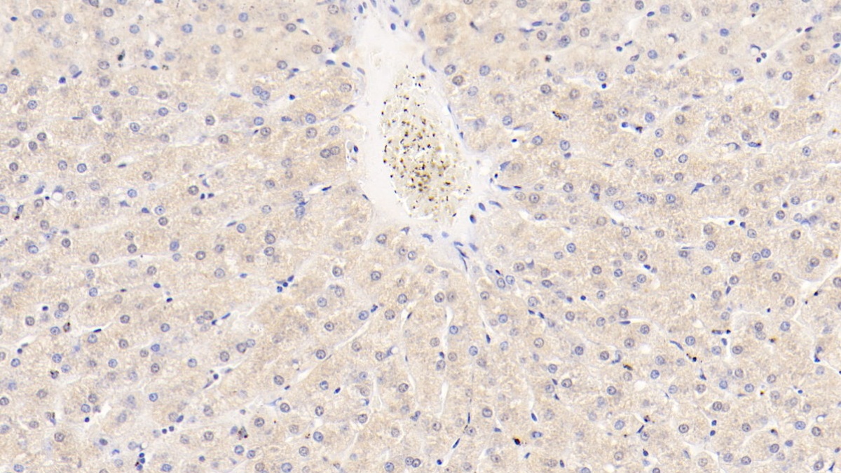 Monoclonal Antibody to Angiopoietin Like Protein 8 (ANGPTL8)