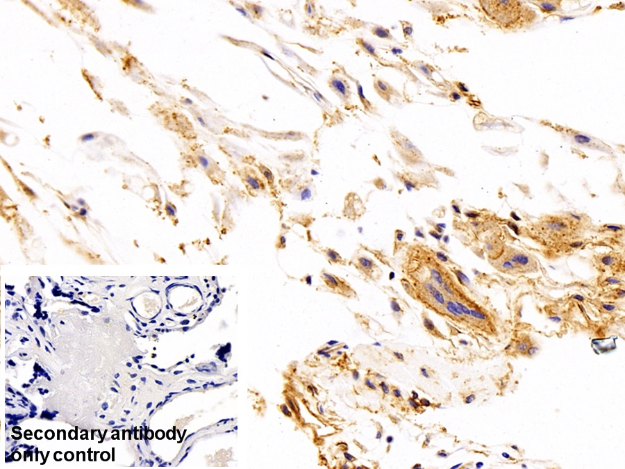 Polyclonal Antibody to Amphiregulin (AREG)