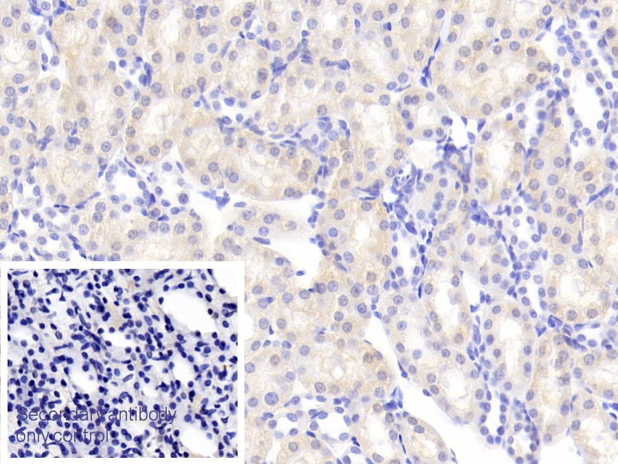 Polyclonal Antibody to Angiogenin (ANG)