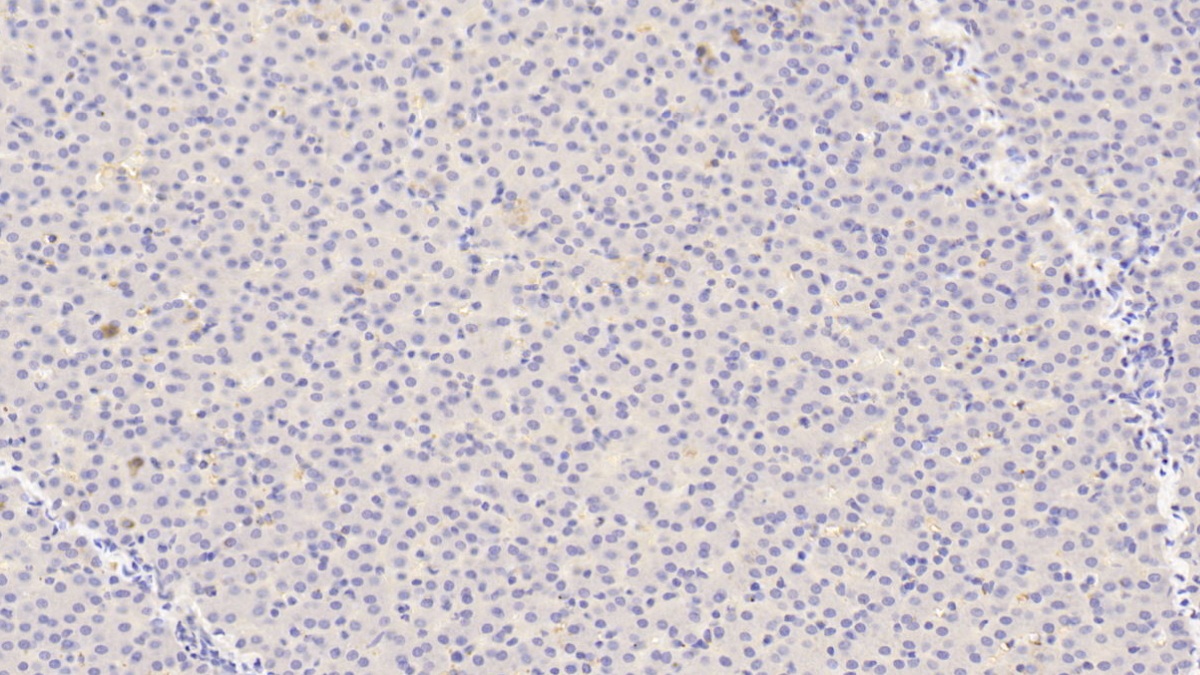 Polyclonal Antibody to Angiopoietin 1 (ANGPT1)