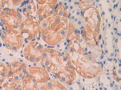 Polyclonal Antibody to Angiopoietin 1 (ANGPT1)