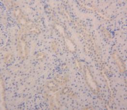 Polyclonal Antibody to Angiopoietin 2 (ANGPT2)