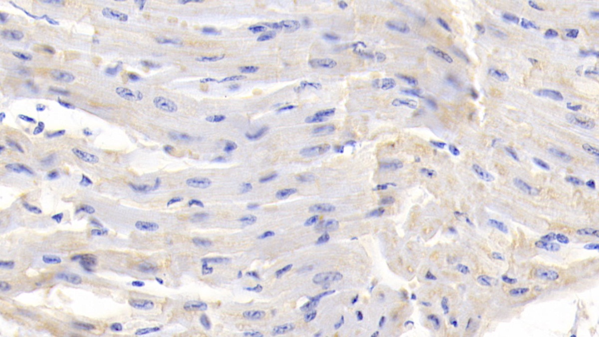 Polyclonal Antibody to Connective Tissue Growth Factor (CTGF)