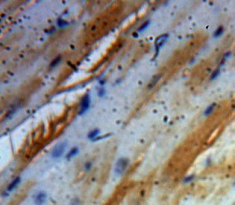 Polyclonal Antibody to Brain Derived Neurotrophic Factor (BDNF)