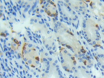 Polyclonal Antibody to Bone Morphogenetic Protein 4 (BMP4)