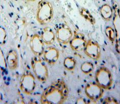 Polyclonal Antibody to E-cadherin