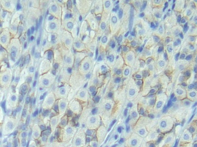 Polyclonal Antibody to E-cadherin