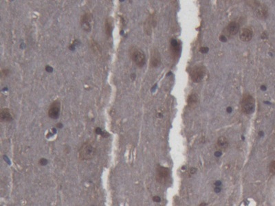 Polyclonal Antibody to Ciliary Neurotrophic Factor (CNTF)