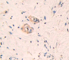 Polyclonal Antibody to Endothelial protein C receptor (EPCR)