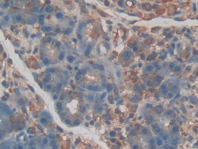 Polyclonal Antibody to Endothelial protein C receptor (EPCR)