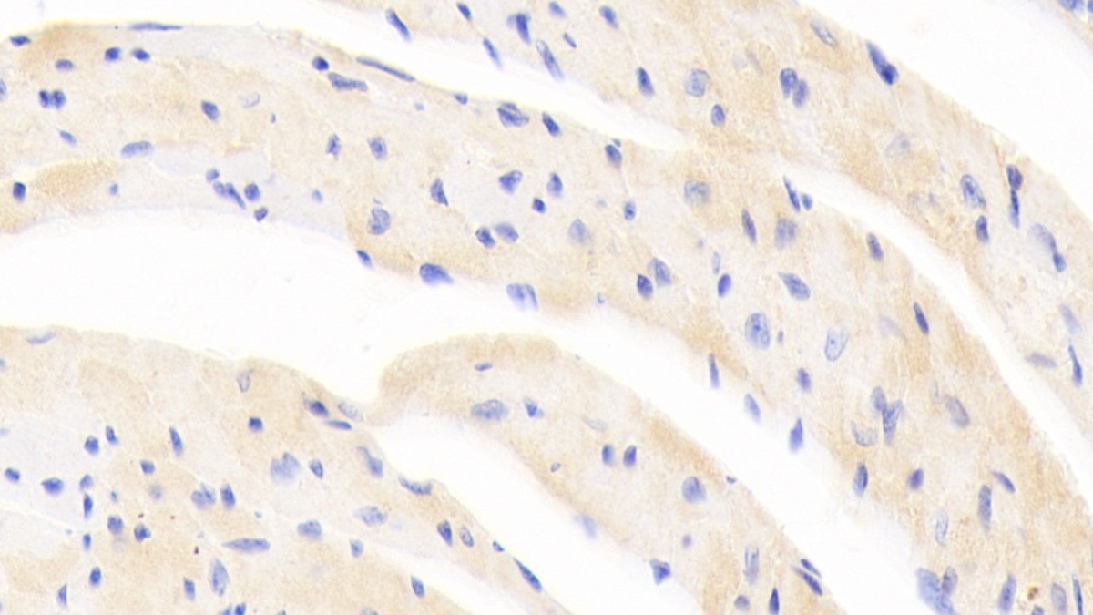 Polyclonal Antibody to Erythropoietin Receptor (EPOR)