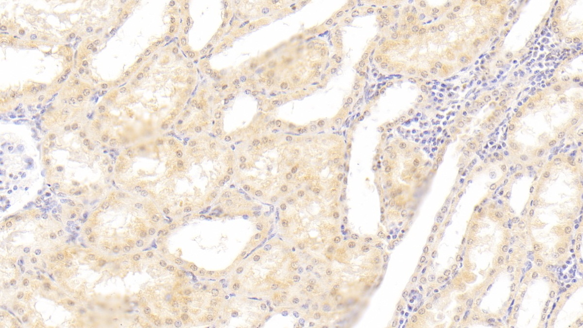 Polyclonal Antibody to Erythropoietin (EPO)