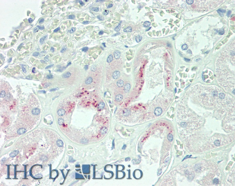 Polyclonal Antibody to Erythropoietin (EPO)