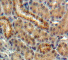 Polyclonal Antibody to Erythropoietin (EPO)