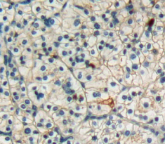 Polyclonal Antibody to Factor Related Apoptosis (FAS)