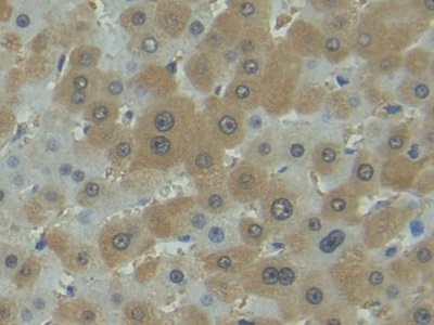 Polyclonal Antibody to Factor Related Apoptosis Ligand (FASL)