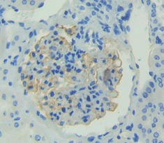 Polyclonal Antibody to Fibroblast Growth Factor 1, Acidic (FGF1)