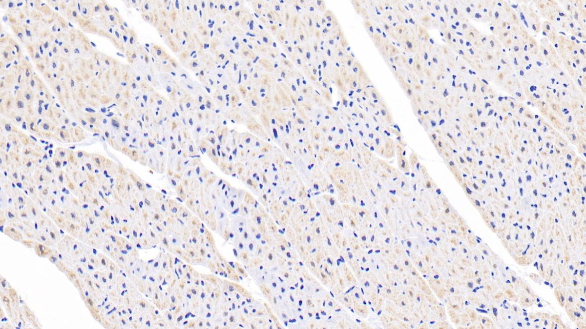 Polyclonal Antibody to Fibroblast Growth Factor 1, Acidic (FGF1)