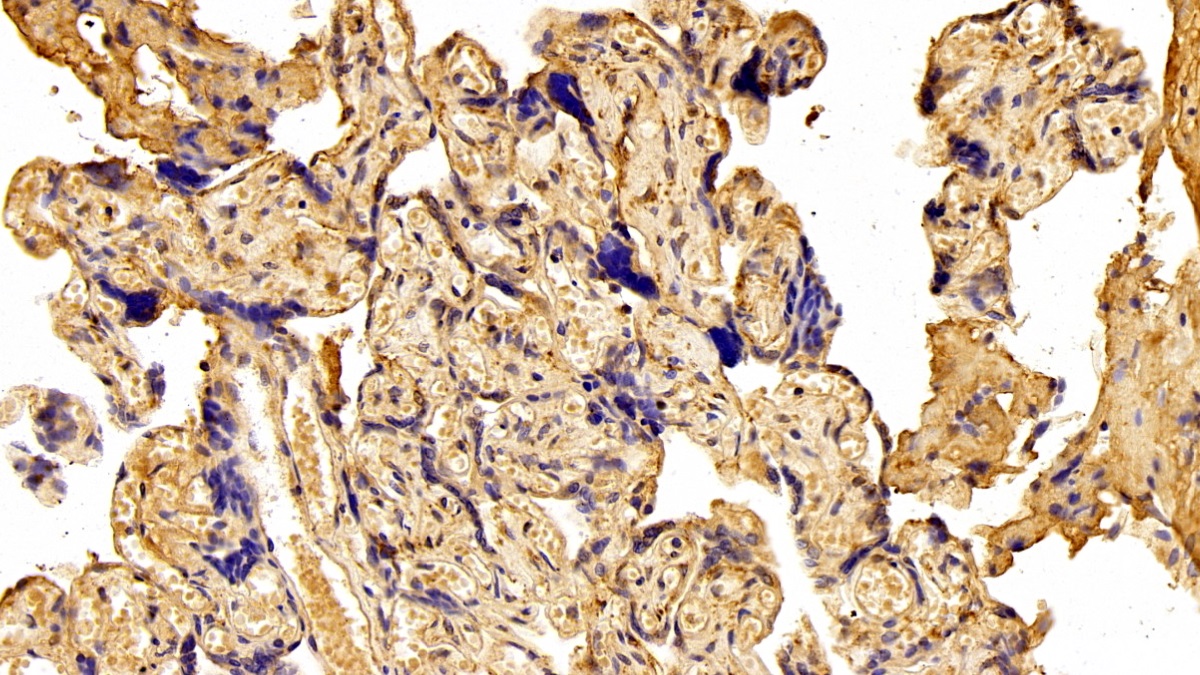 Polyclonal Antibody to Fibronectin (FN)