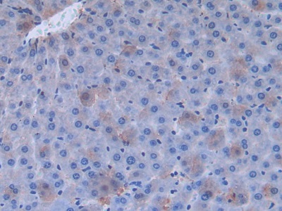 Polyclonal Antibody to Fibronectin (FN)