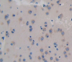 Polyclonal Antibody to Colony Stimulating Factor 3, Granulocyte (GCSF)