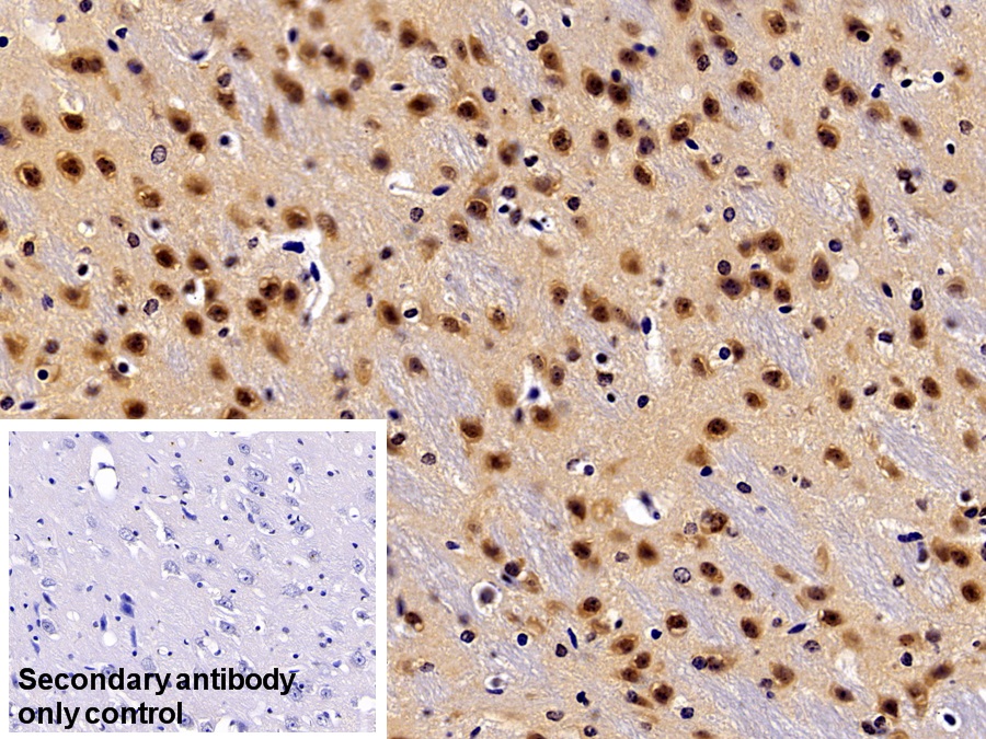 Polyclonal Antibody to Glial Cell Line Derived Neurotrophic Factor (GDNF)