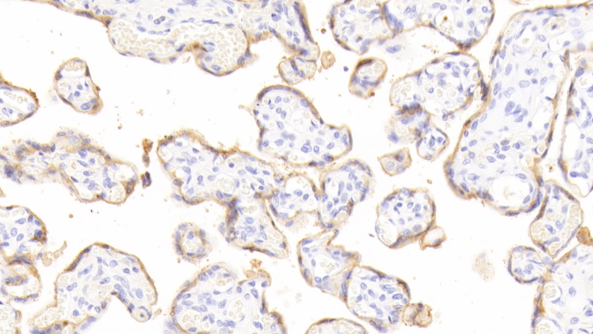 Polyclonal Antibody to Growth Hormone (GH)