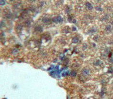 Polyclonal Antibody to Growth Hormone (GH)