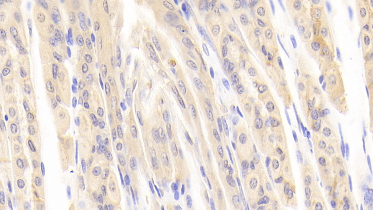 Polyclonal Antibody to Inhibin Beta E (INHbE)