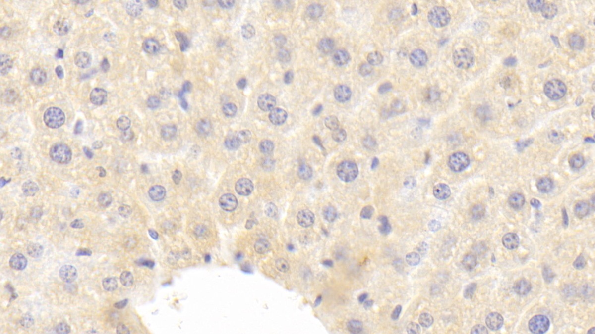Polyclonal Antibody to Insulin Like Growth Factor 1 (IGF1)