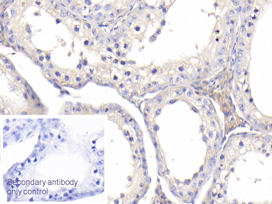 Polyclonal Antibody to Insulin Like Growth Factor Binding Protein 1 (IGFBP1)