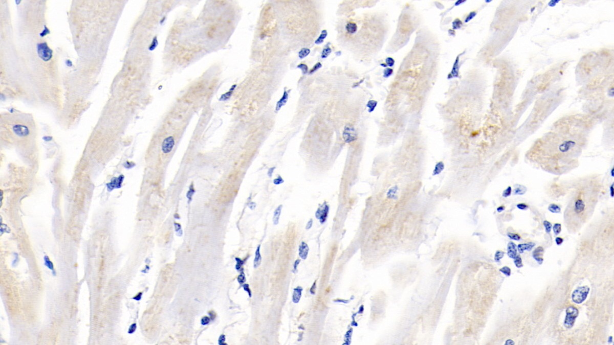 Polyclonal Antibody to Insulin Like Growth Factor Binding Protein 2 (IGFBP2)