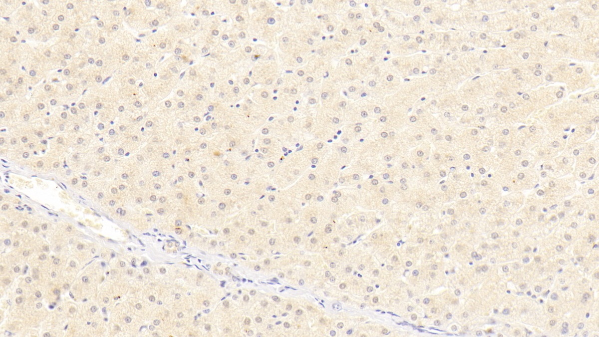 Polyclonal Antibody to Insulin Like Growth Factor Binding Protein 4 (IGFBP4)
