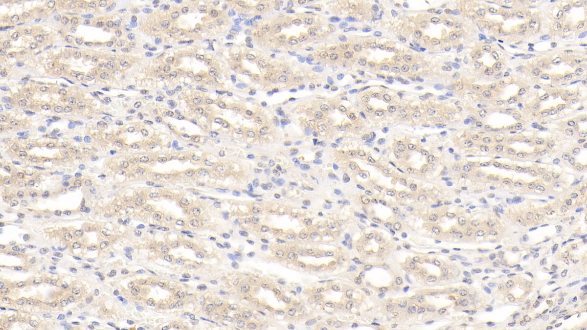 Polyclonal Antibody to Interleukin 12B (IL12B)