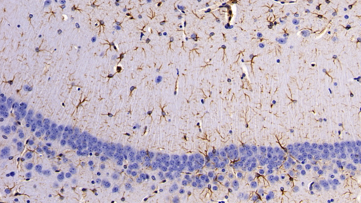 Polyclonal Antibody to Glial Fibrillary Acidic Protein (GFAP)