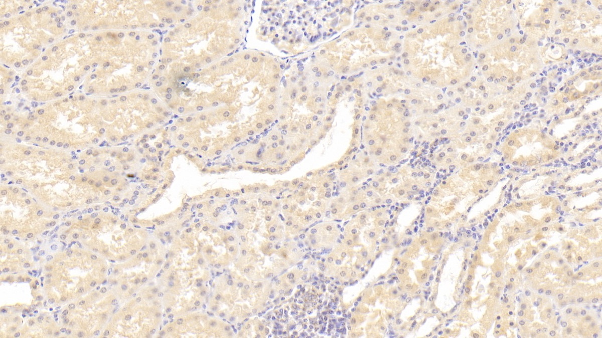 Polyclonal Antibody to Meningioma Expressed Antigen 5 (MGEA5)