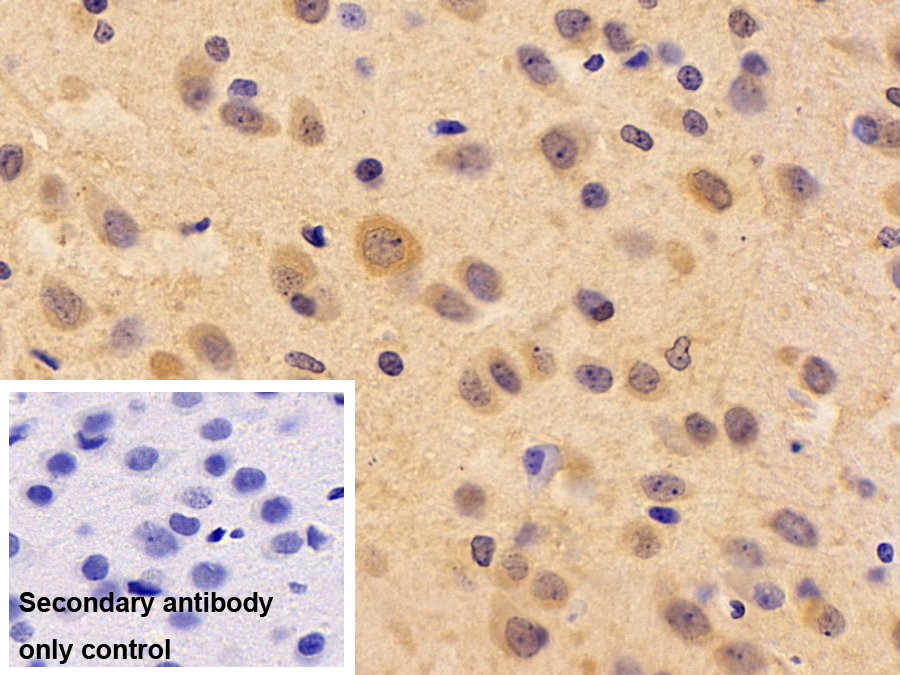 Polyclonal Antibody to Meningioma Expressed Antigen 5 (MGEA5)