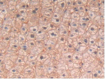 Polyclonal Antibody to Interleukin 4 (IL4)