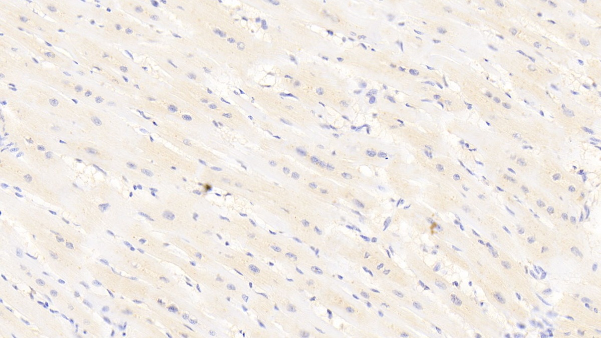 Polyclonal Antibody to Leptin Receptor (LEPR)