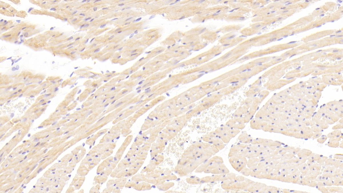 Polyclonal Antibody to Leptin Receptor (LEPR)