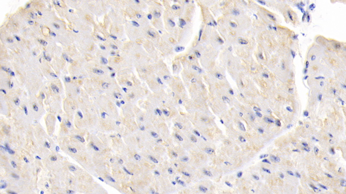 Polyclonal Antibody to Leptin (LEP)