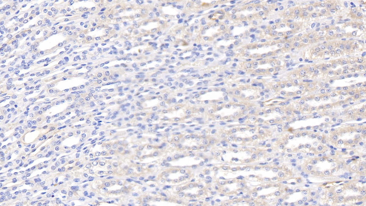 Polyclonal Antibody to Leptin (LEP)