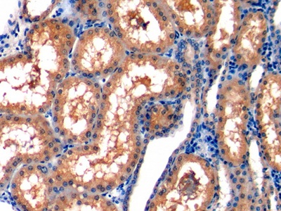 Polyclonal Antibody to Monocyte Chemotactic Protein 1 (MCP1)